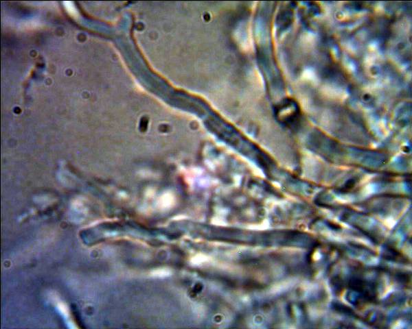 Oligoporus?? (Skeletocutis amorpha)